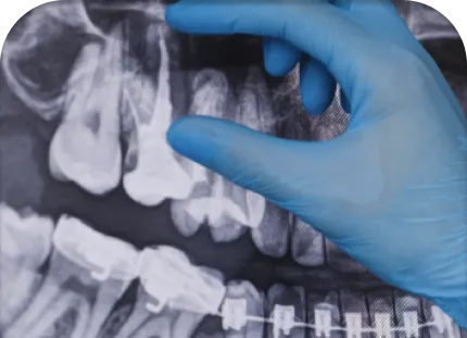 kid-dental-xray kid dental - Guadalupe Kids Dental