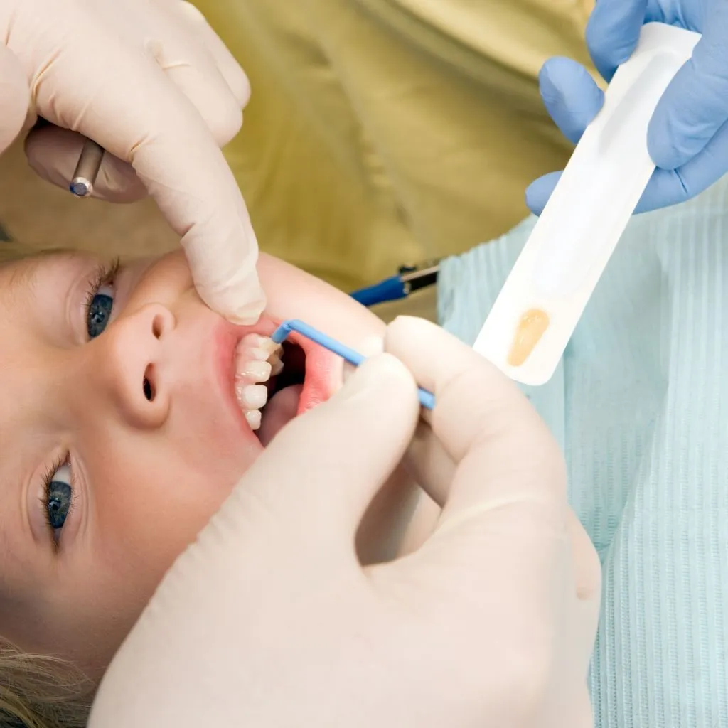 kid fluoride treatment kid fluoride treatment
