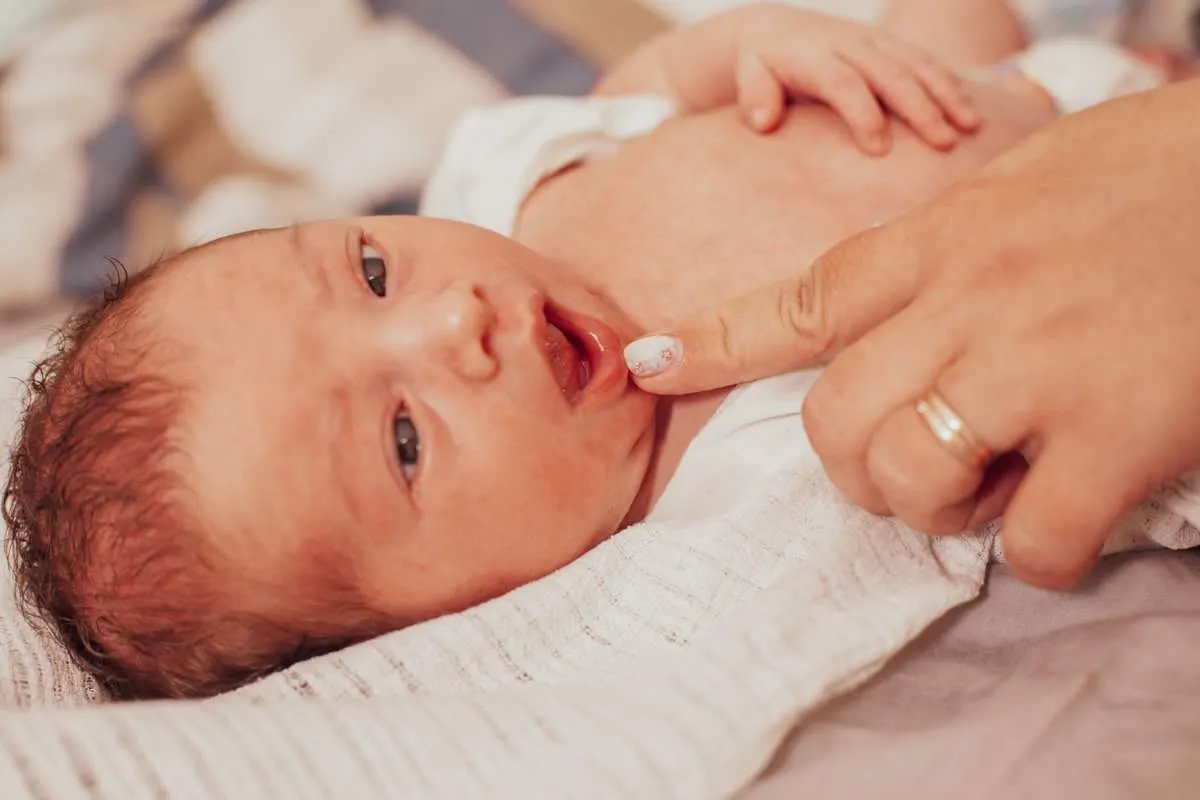 The examination of newborn baby mouth, short frenulum of the tongue
