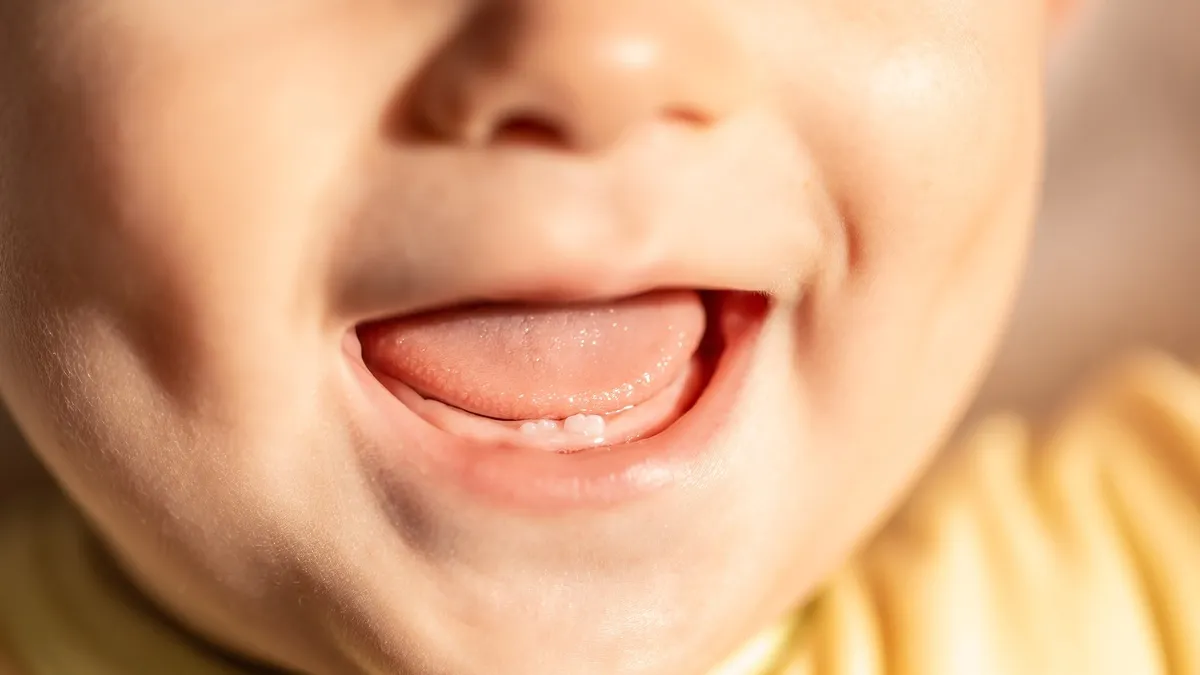 Close-up open baby mouth to examine first teeth. Infant tooth Close-up open baby mouth to examine first teeth. Infant tooth
