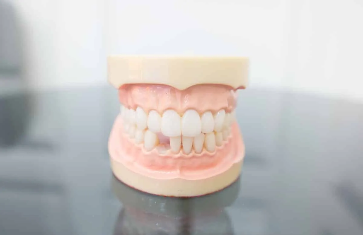 Close up picture mouth with dental problems showing missing tooth. concept Dental health care. Hygiene teeth. Dentistry Close up picture mouth with dental problems showing missing tooth. concept Dental health care. Hygiene teeth. Dentistry