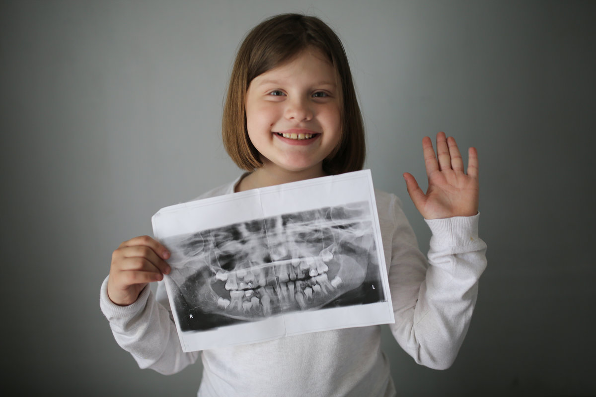 x-ray of calf's and permanent teeth in hands child girl with x-ray snapshot of teeth, x-ray of calf's teeth and permanent teeth in the hands of a child. Funny children's emotions and children's health, dentistry