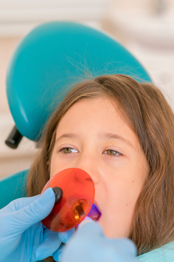 girl getting dental filling treatment at molar tooth with ultraviolet technology. Image of little girl having her teeth checked by doctor. vertical photo girl getting dental filling treatment at molar tooth with ultraviolet technology. Image of little girl having her teeth checked by doctor. vertical photo.