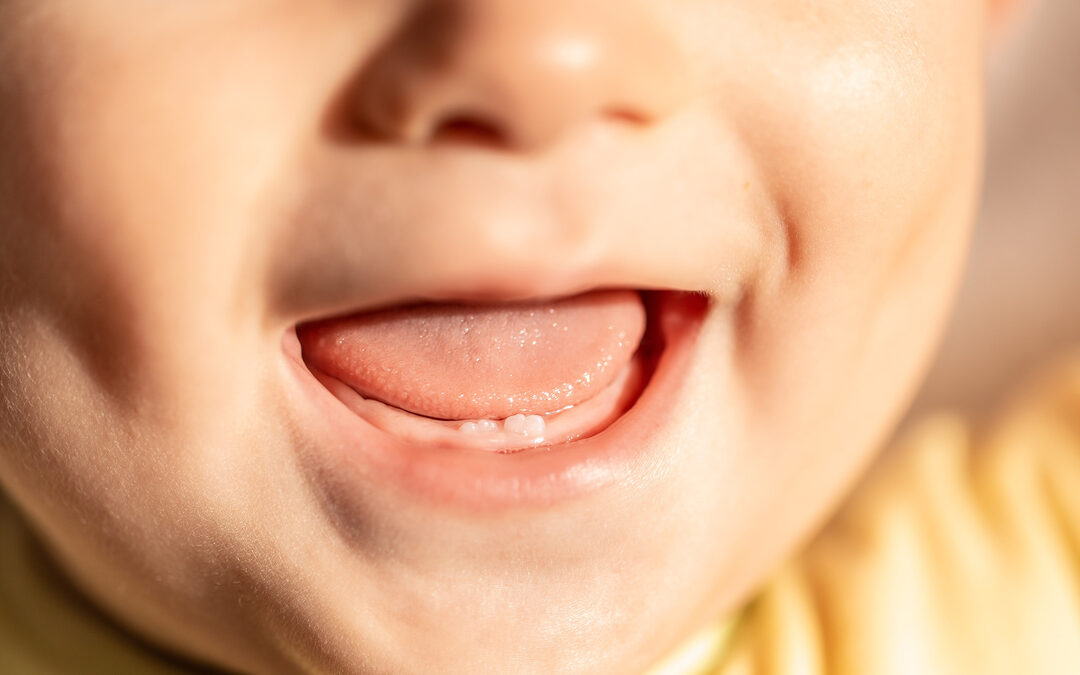 What Can You Expect During Your Infant’s First Tooth Eruption?