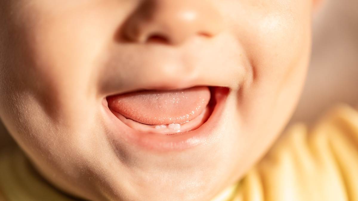 Close-up open baby mouth to examine first teeth. Infant tooth